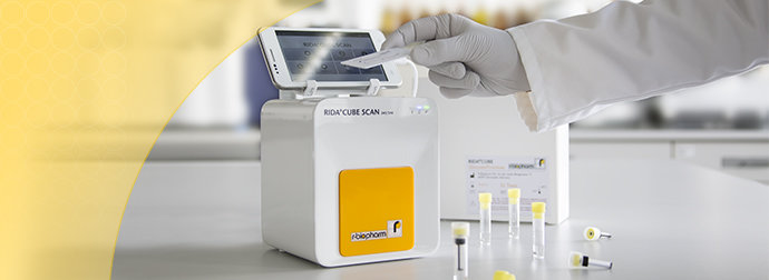 Automated enzymatic analyzer – RIDA CUBE SCAN