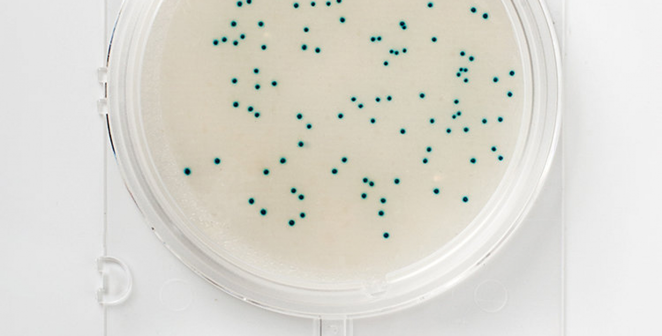 Compact Dry ETC (en) Food & Feed Analysis